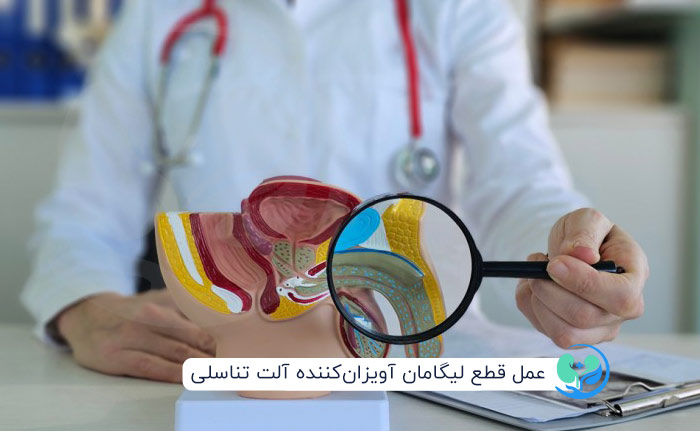 جراحی قطع لیگامان