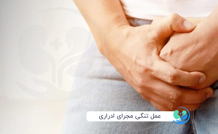 عمل تنگی مجرای ادراری