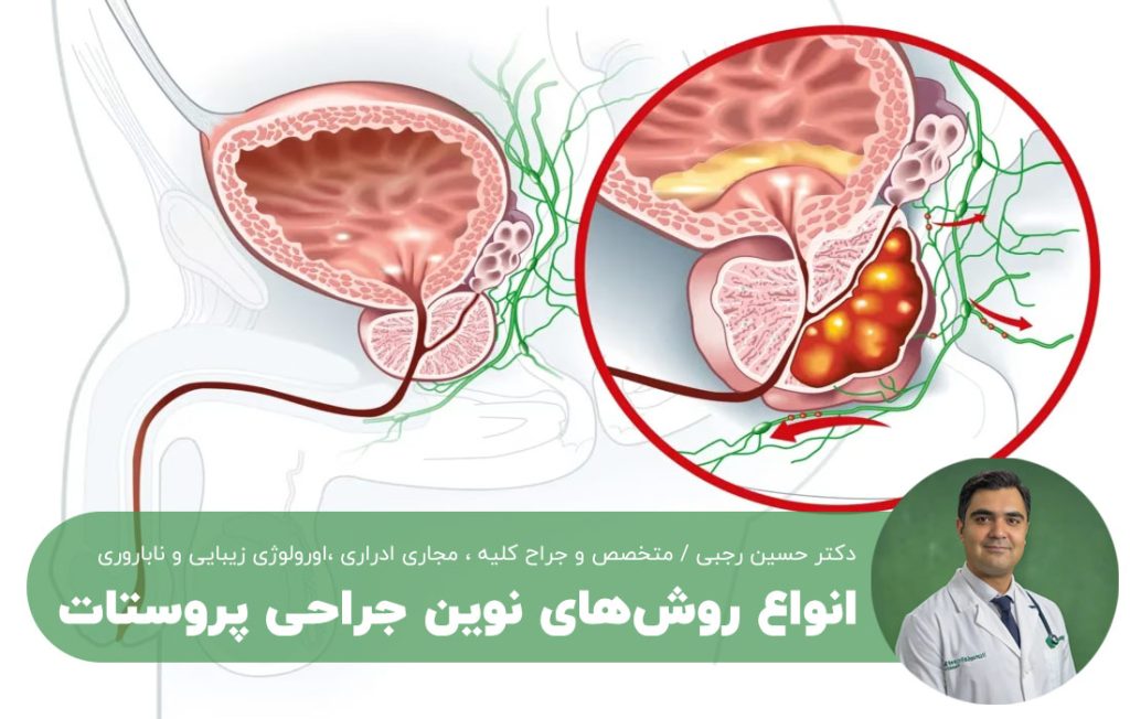 انواع روش‌های نوین جراحی پروستات 