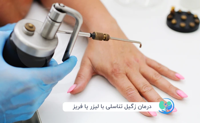 درمان زگیل تناسلی با لیزر یا فریز