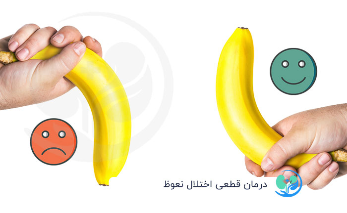 درمان اختلال نعوظ