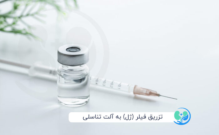 تزریق فیلر به آلت تناسلی