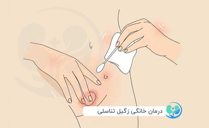 درمان خانگی زگیل تناسلی